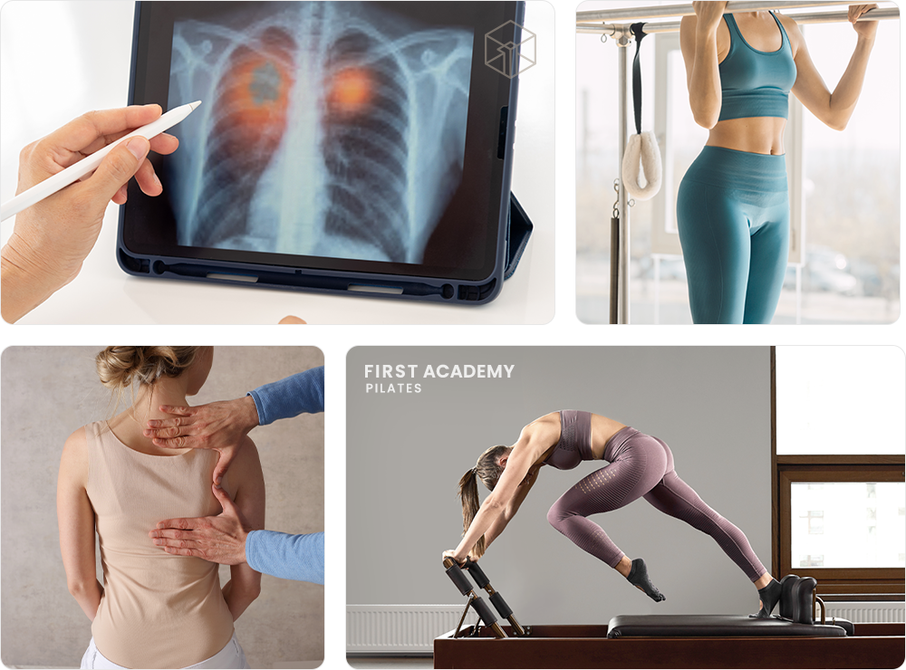 척추측만증교정운동